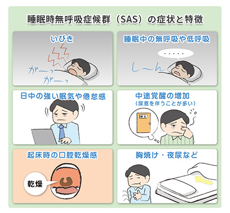 睡眠時無呼吸症候群（SAS）の症状と特徴